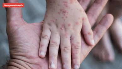 NOP VIRUS