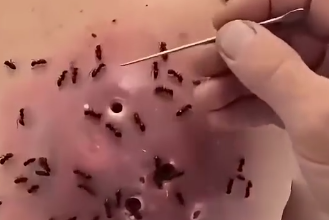 Cuando una molestia persistente finalmente tuvo una explicación